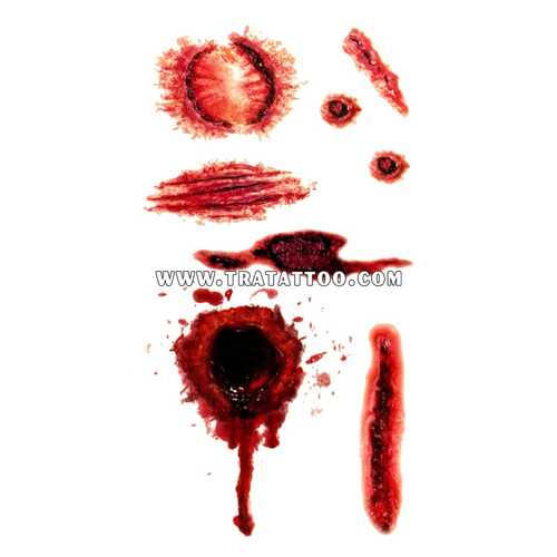 Wound